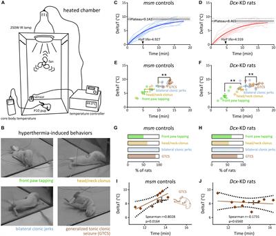 Frontiers Size Of Subcortical Band Heterotopia Influences The